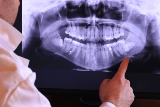 Best Broken Tooth Emergency  in Parkersburg, IA